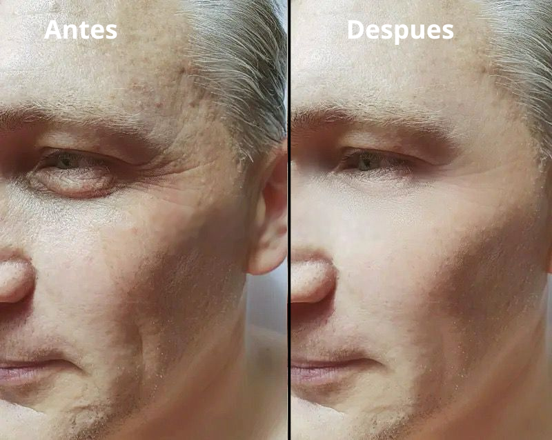 Colágeno Eelhoe Crema Anti-edad - Antiarrugas 2X1