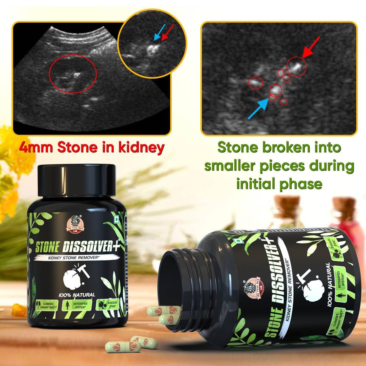 SUPLEMENTO RENAL 🔥Renueva Tus Riñones y Tu Vida 💧 Sin Cirugías Ni Dolor 😌